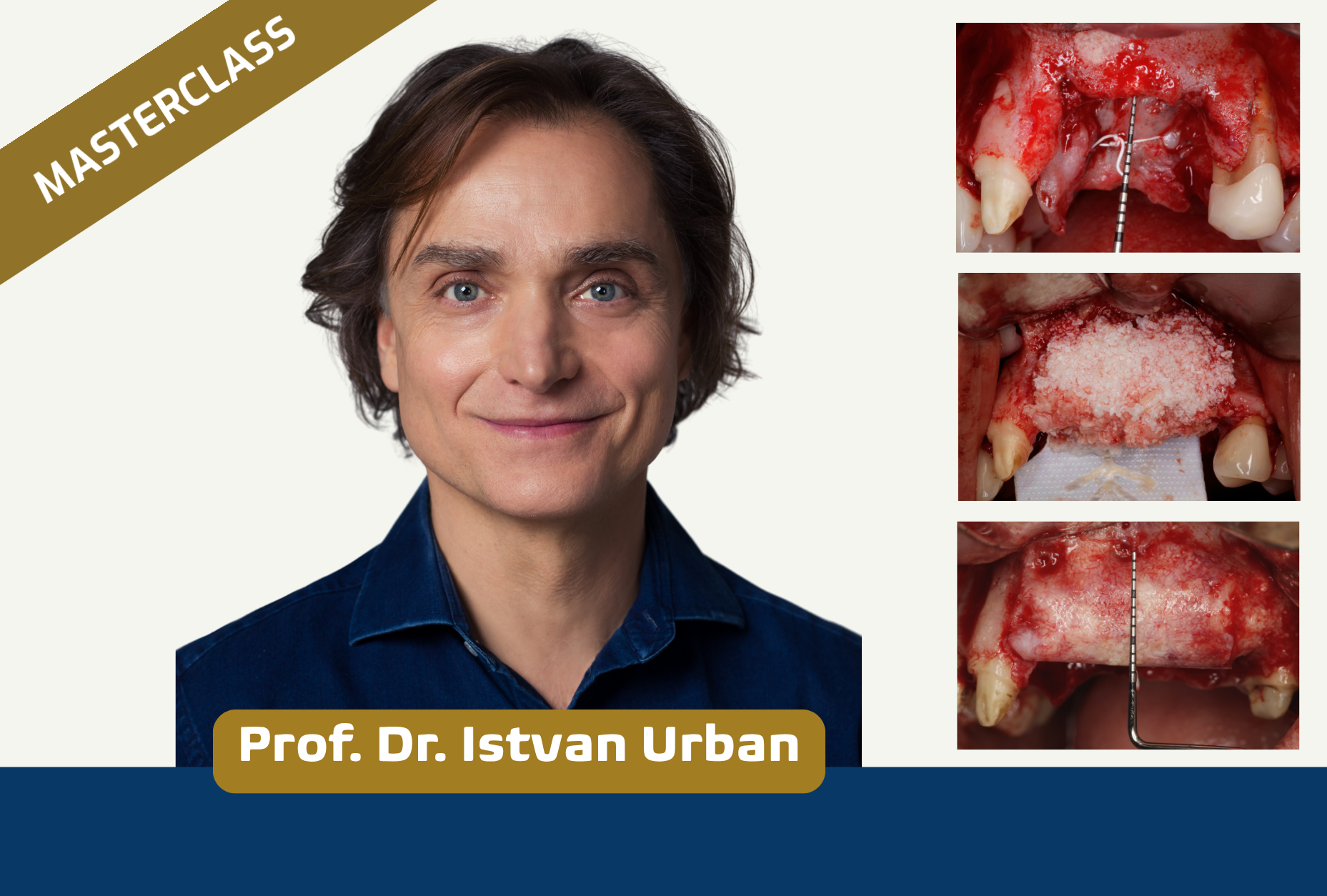 Advanced Bone and Soft Tissue Course - A 1.5-day Theoretical and Hands-on Surgery Course